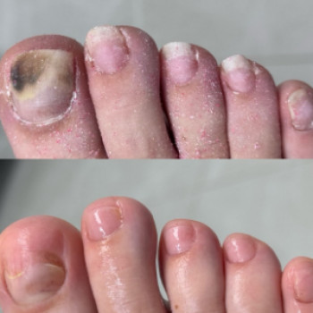 Інна Захарук, Снятин Фото - 5