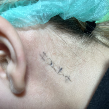 До процедури