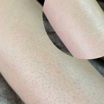 Анна Кравчук, Луцк Фото - 12