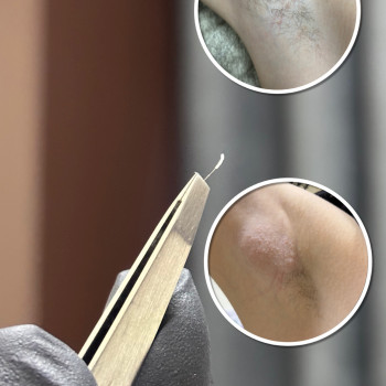 Анна Кравчук, Луцк Фото - 13