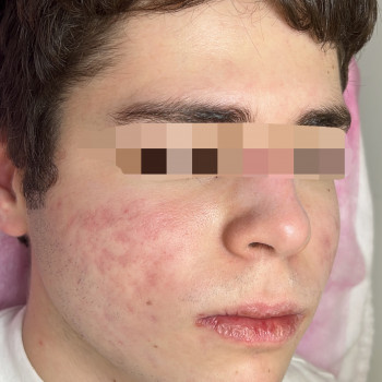 Dr. Nikrasova cosmetology, Київ Фото - 11