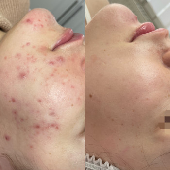 Dr. Nikrasova cosmetology, Київ Фото - 12