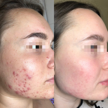 Dr. Nikrasova cosmetology, Київ Фото - 13