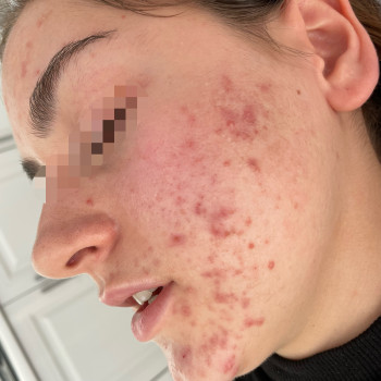 Dr. Nikrasova cosmetology, Київ Фото - 16