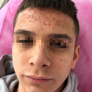 Dr. Nikrasova cosmetology, Київ Фото - 17