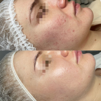 Dr. Nikrasova cosmetology, Київ Фото - 19