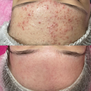 Dr. Nikrasova cosmetology, Київ Фото - 22