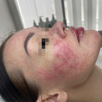 Dr. Nikrasova cosmetology, Київ Фото - 23