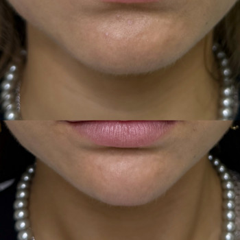 Dr. Nikrasova cosmetology, Київ Фото - 4