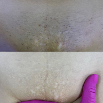 Sugar Boss, Трускавец Фото - 5