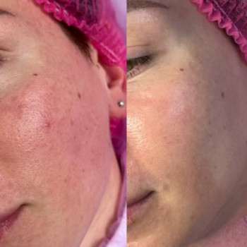 Анастасія Кулядинова, Миколаїв Фото - 5