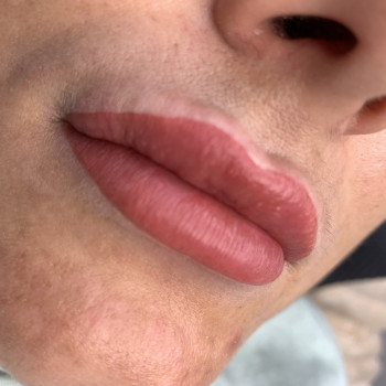 Алла Димова, Болград Фото - 31