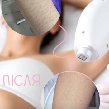 Laser Top, Миколаїв Фото - 5