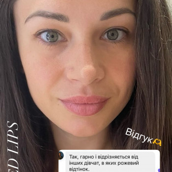 Загоєні губки