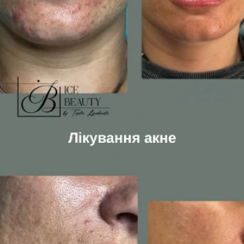 Людмила Тепла, Баштанка Фото - 5