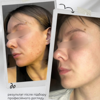 Людмила Тепла, Баштанка Фото - 6