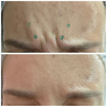 Людмила Патек, Ужгород Фото - 8