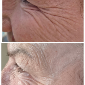 Людмила Патек, Ужгород Фото - 7