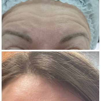 Людмила Патек, Ужгород Фото - 6