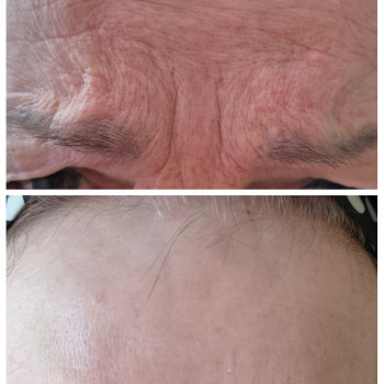 Людмила Патек, Ужгород Фото - 5