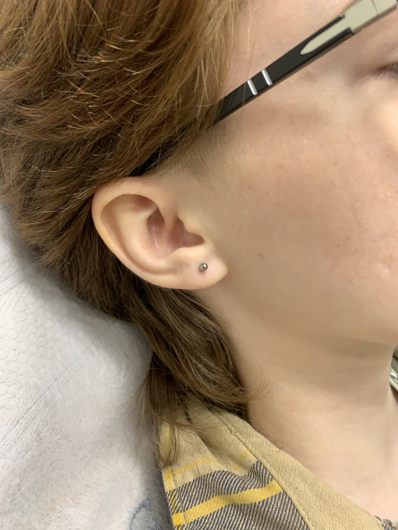 Прокол мочок вух, фото - Майстер з пірсингу Тетяна Ананьєва
