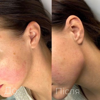 Центр лазерної косметології