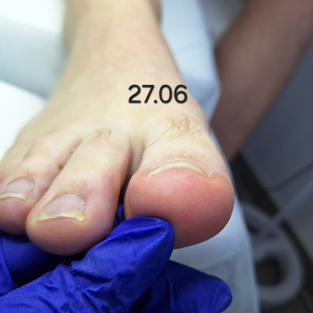 Юлія Пилипенко, Черкаси Фото - 8