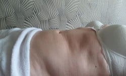 Лимфодренажный массаж тела Массажист Елизавета Киев