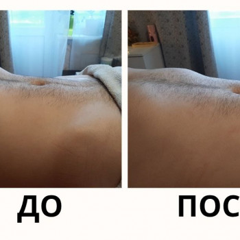 ЧіНейЦзан (вісцеральний масаж живота)
                    Массажист Елизавета Киев