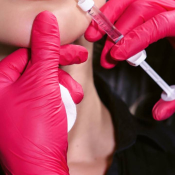 Курс контурної пластики губ