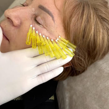 Курси мікронідлінгу