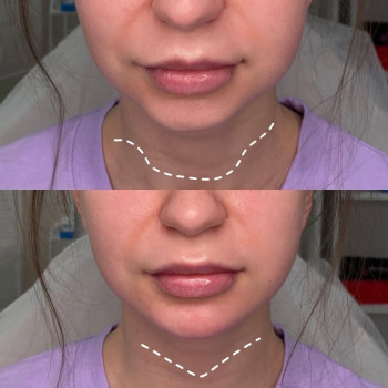 Тетяна Гулвакова, Одеса Фото - 5