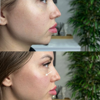 Тетяна Гулвакова, Одеса Фото - 6