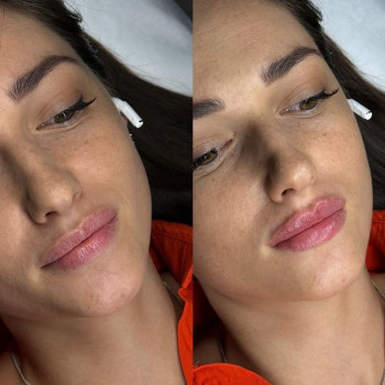 Олена Лупашко, Одеса Фото - 5