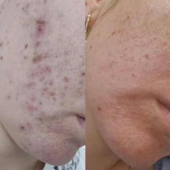 Яна Дымова, Одесса Фото - 5