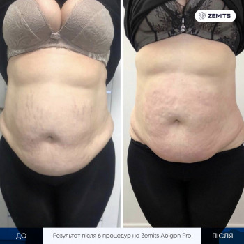 Результати, які радують