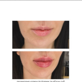 Валентина Болюк, Запорожье Фото - 5