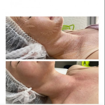 Валентина Болюк, Запорожье Фото - 6