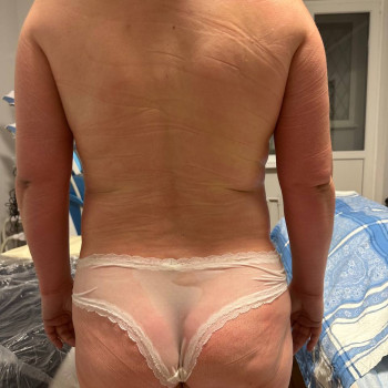 Масаж ручний антицелюлітний Київ Позняки
                    Реабілітолог Юлия Київ