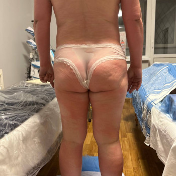 Масаж ручний антицелюлітний Київ Позняки
                    Реабілітолог Юлия Київ