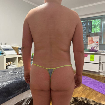 Масаж ручний антицелюлітний Київ Позняки
                    Реабілітолог Юлия Київ