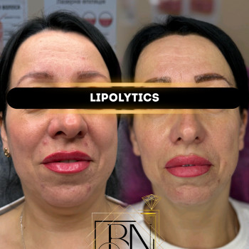 Наталья Булавина, Харьков Фото - 5