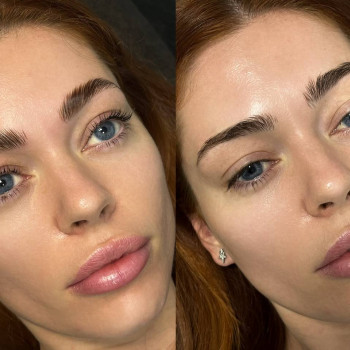 Ламінування вій та брів
                    Салон красоты Fargo Киев