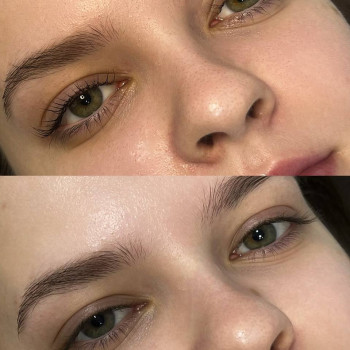 Ламінування вій та брів
                    Салон красоты Fargo Киев