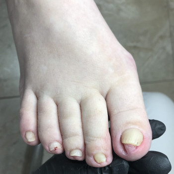 Дана Драпака, Чернівці Фото - 9