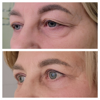 Алла Виленская, Днепр Фото - 1