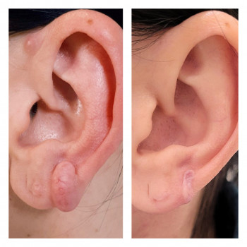 Алла Виленская, Днепр Фото - 2