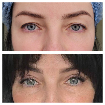 Алла Виленская, Днепр Фото - 4