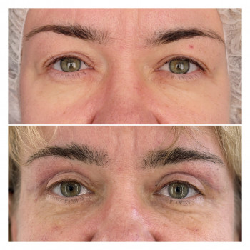 Алла Виленская, Днепр Фото - 8