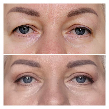 Алла Виленская, Днепр Фото - 10